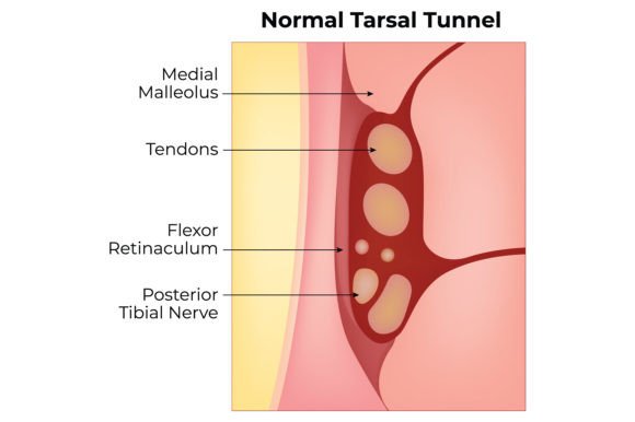 Download Normal Tarsal Tunnel Science Design - Design Collection